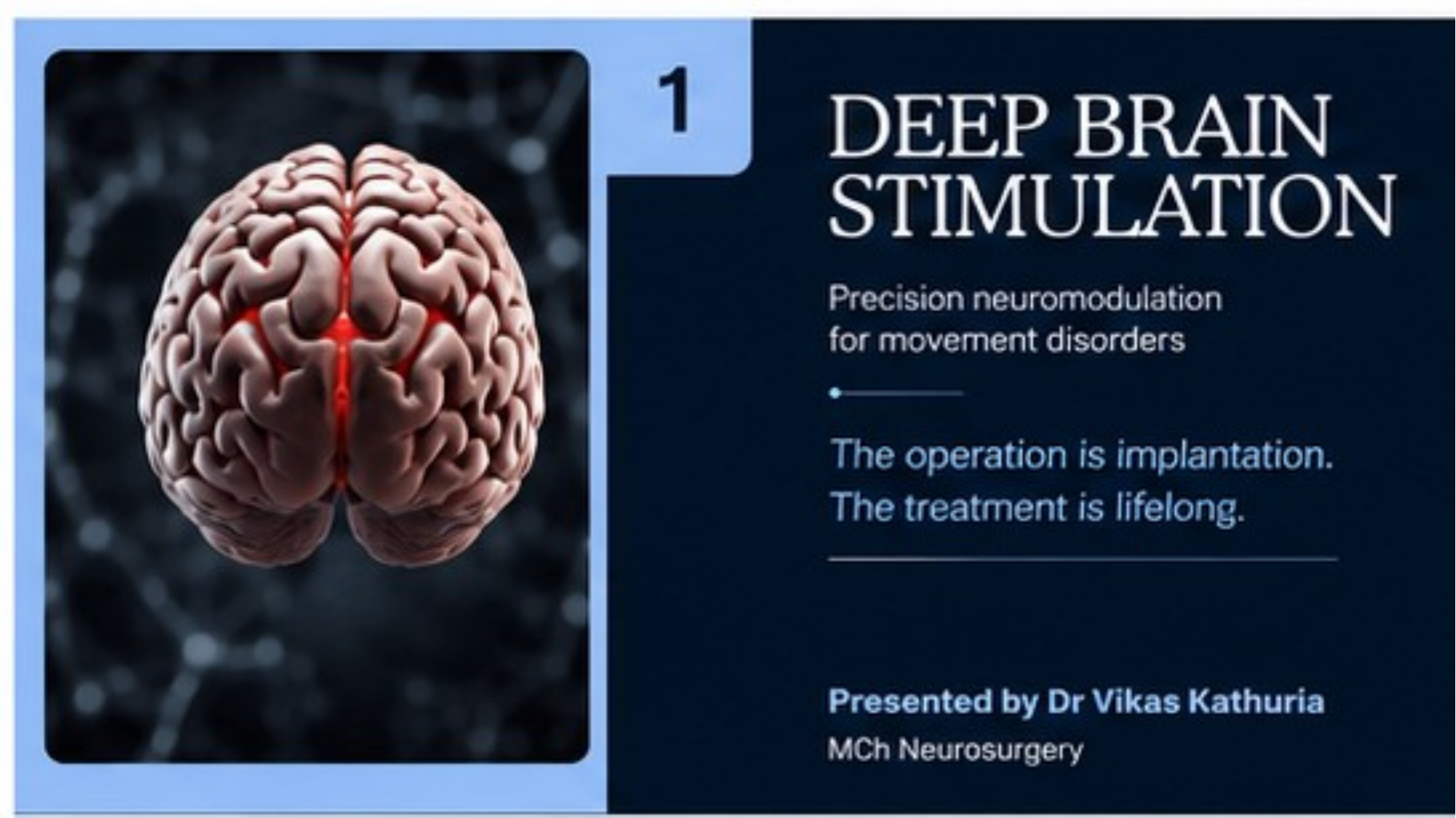 Original lecture slide 1 introducing Deep Brain Stimulation