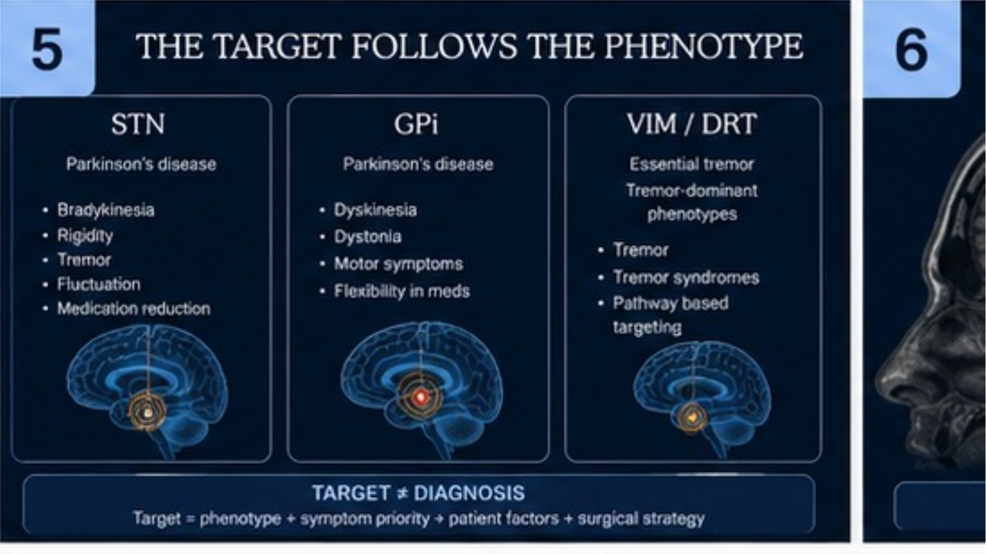 Original lecture slide 5 comparing STN, GPi and VIM/DRT targets
